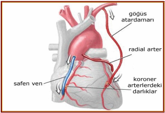 Kalp ameliyatlarında Yeni dönem!