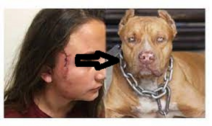 PİTBULL DEHŞETİ DEVAM EDİYOR!